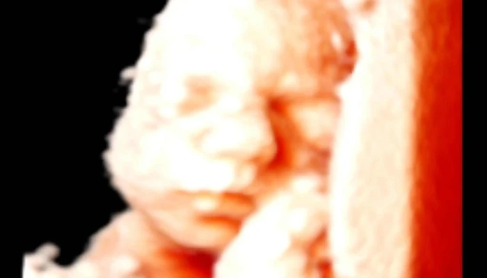 Tiason 5d Diagnosztika Kozmetologia Es Oxigenterapia Egeszsegugyi Diagnosztikai Kepalkoto Kozpont - Győr
